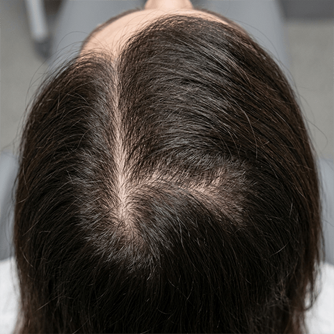 After Treatment